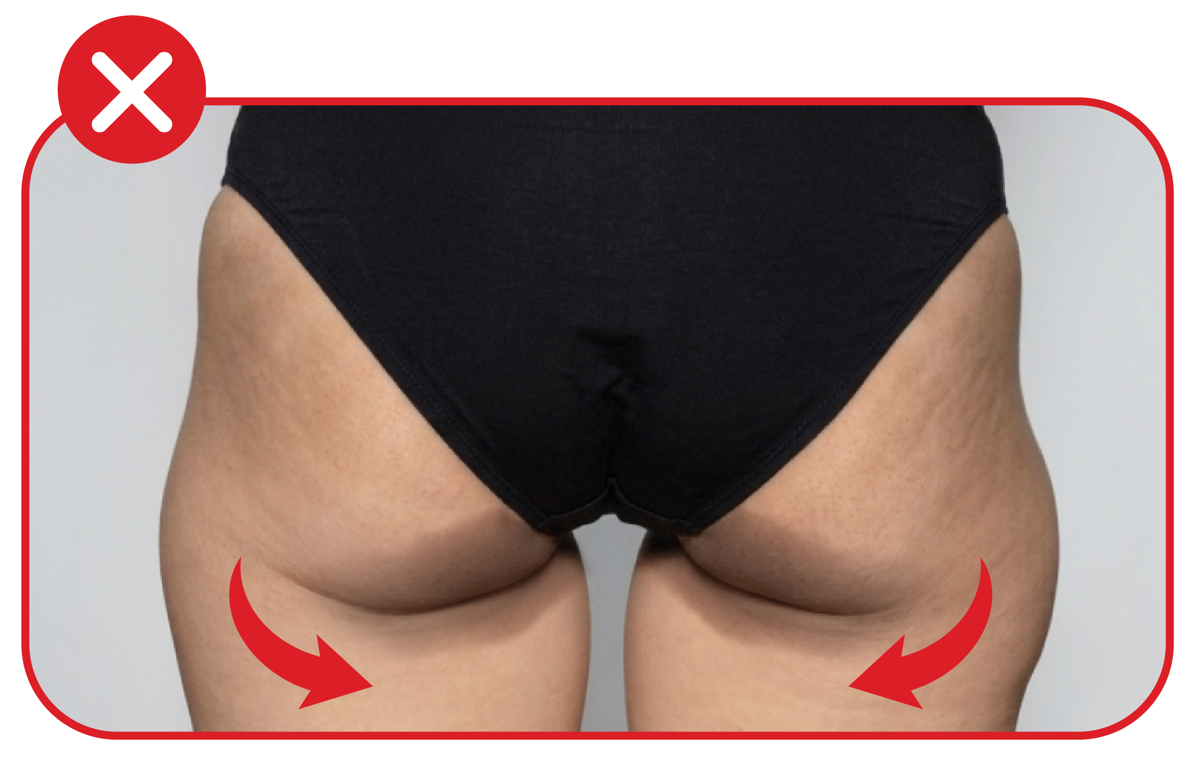 NoYa Swag Moon — hips before use, soft and sagging